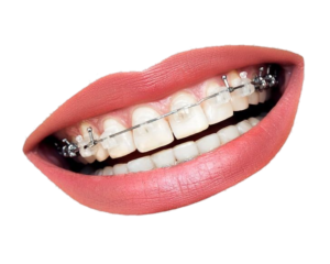 Teeth-13