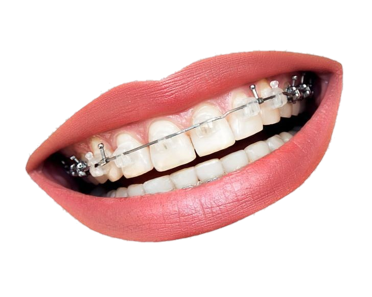Dental Teeth Mouth Png