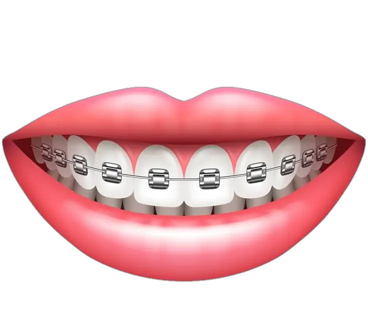 Dental Mouth Teeth Png