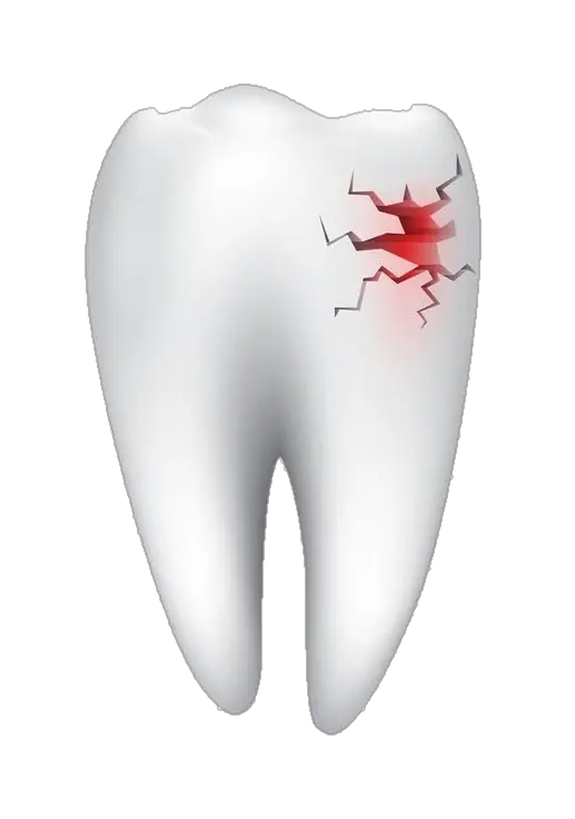 Broken Single Teeth Png