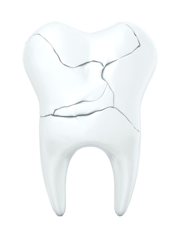 Broken Dental Teeth Png