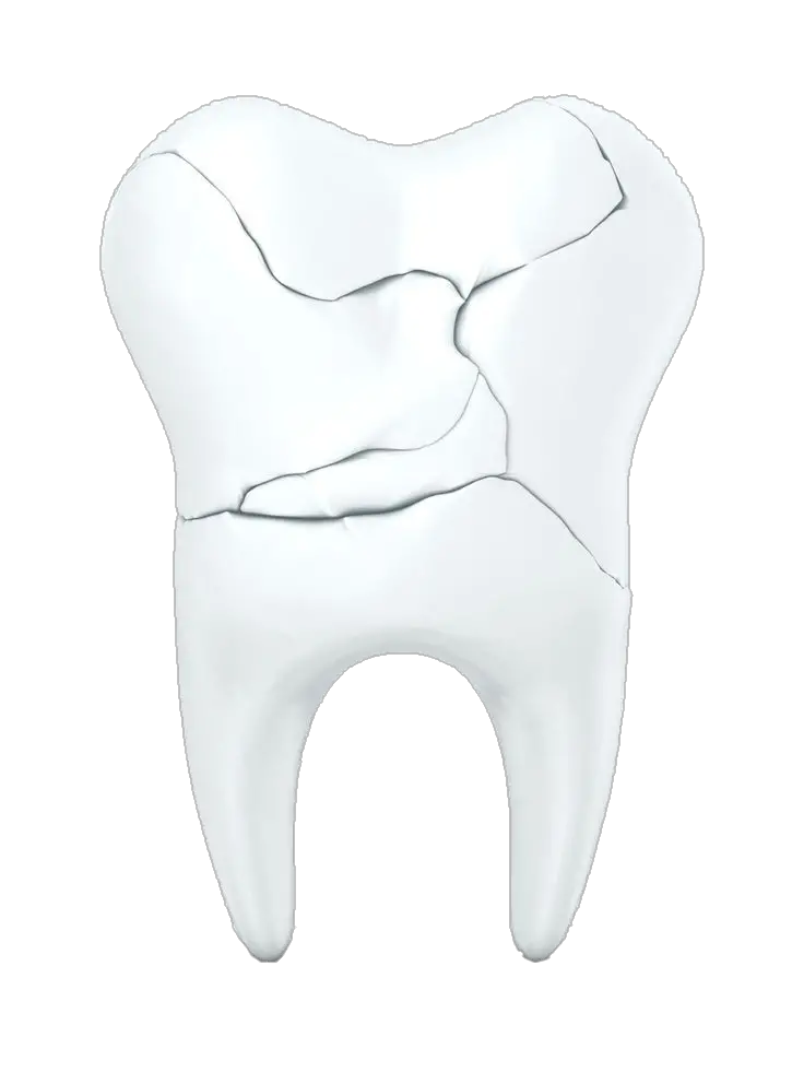 Broken Dental Teeth Png