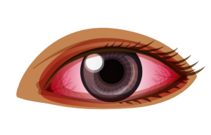 Infected Eye clipart Png