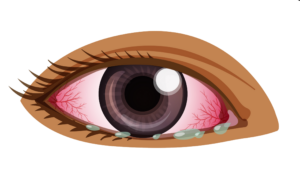 Infected Human Eye Vector Png