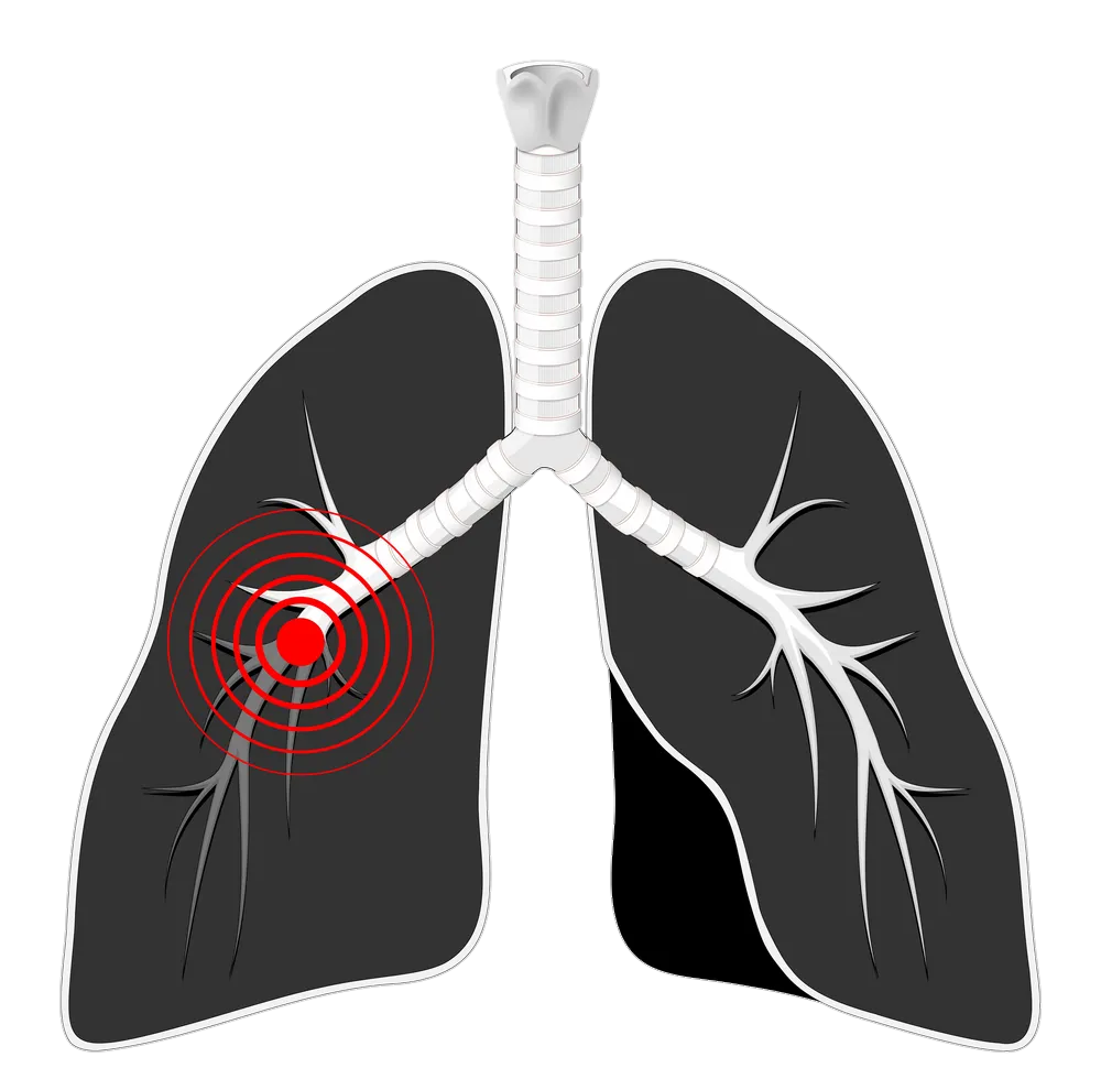 Human Black Lungs Vector Png