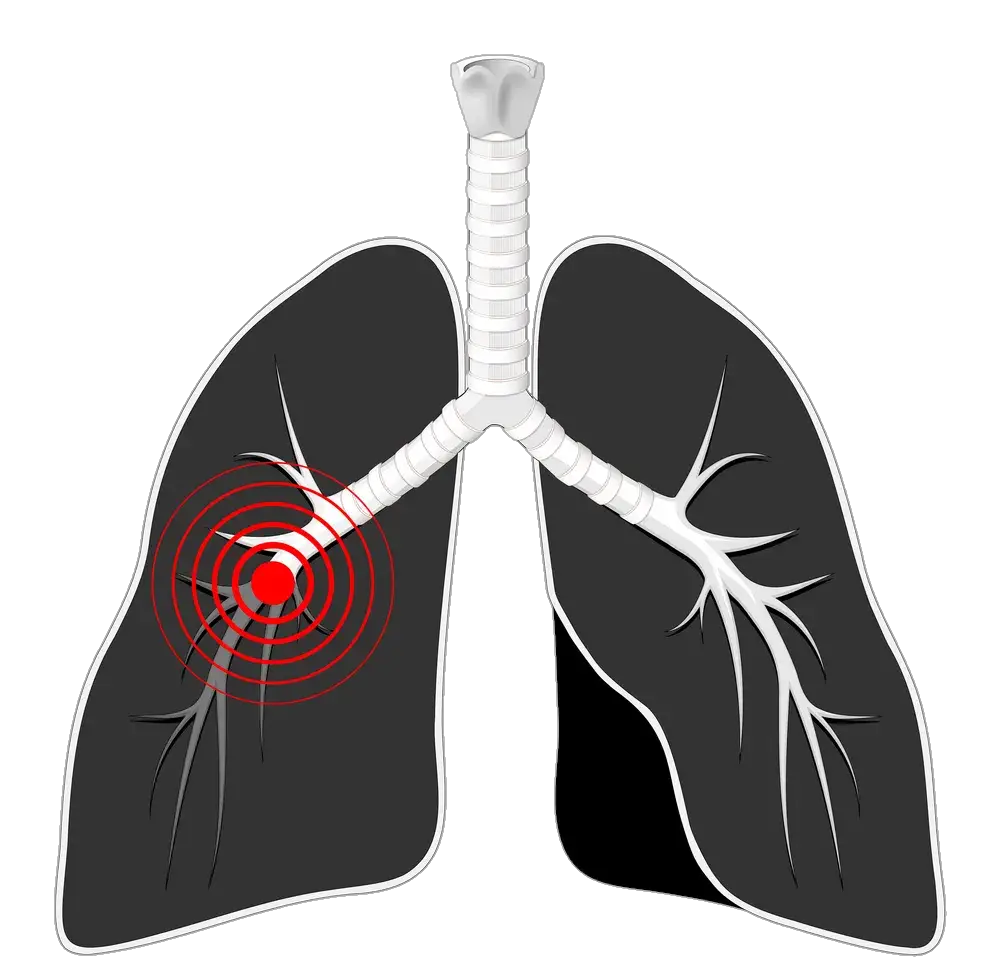 lung-6